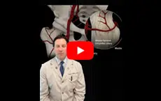 Dr. Domb explains David Bell injury - Educational Video