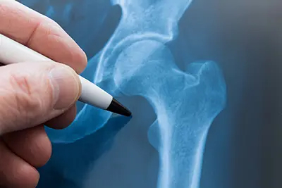 Abigail Roberts, PA-C, MPAS