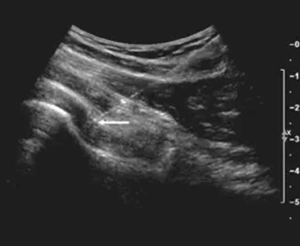 Non-Surgical Treatments