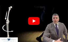 Dr. Sugarman explains Stefon Diggs injury - Educational Video