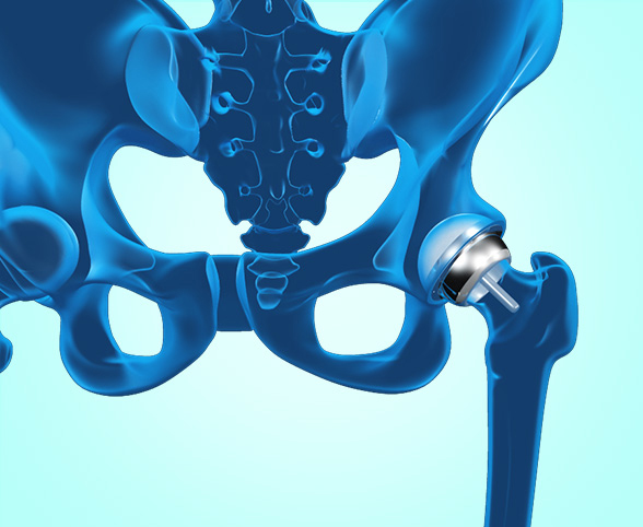 Surgical Treatment Options Offered by Dr. Domb