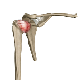 Capsular Release (Frozen Shoulder) - Picture