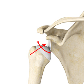 Multidirectional Instability of the Shoulder img