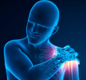 Shoulder Stiffness Surgery img