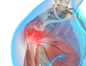 Shoulder Trauma - Picture