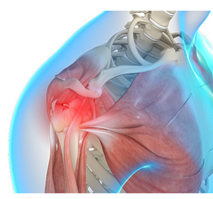 Shoulder Trauma img