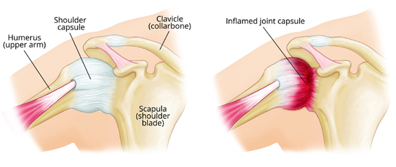 smooth tissues of the shoulder img