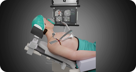 Enabling Technologies in Shoulder Surgery - Picture