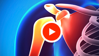 Patient Educational Videos
