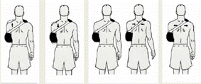 upright and wearing the sling img