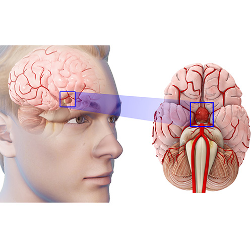 Pituitary Tumours