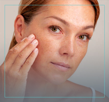 New York City's Top Dermatologist, Debra Jaliman, treating Pigment Problems