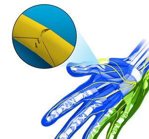 Microvascular Surgery img