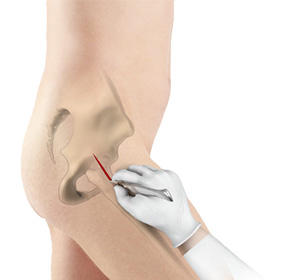 Minimally Invasive img