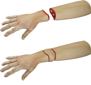 Post-traumatic Reconstruction img