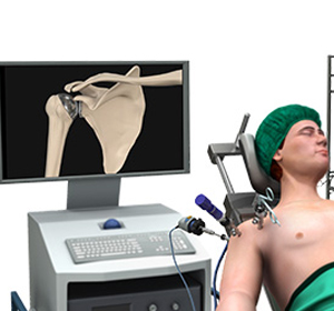 Shoulder Surgery img