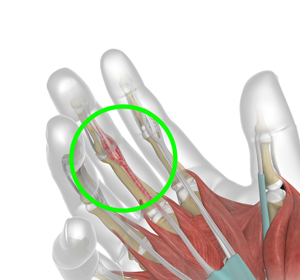 Upper Extremity Tendon Transfers img