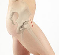 Total Hip Replacement