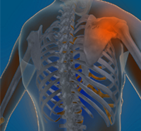 Shoulder Injuries in the Throwing Athlete