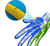 Hand Peripheral Nerve Surgery