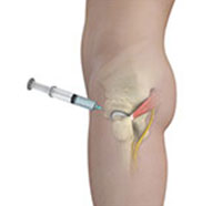 Hip Injections