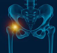 Hip Pain