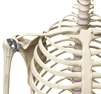 Shoulder Joint Replacement