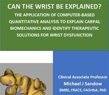 Can the Wrist be explained