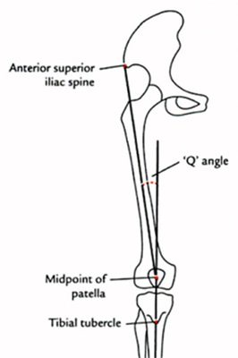 Picture of The Q angle (Quadriceps angle)