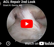 2nd Look ACL repair 2 years out