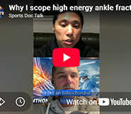 Why I scope high energy ankle fractures