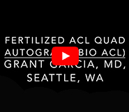 Fertilized ACL Using Quad Autograft