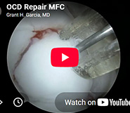 MFC OCD repair with absorbable screws