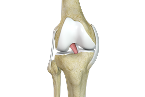 Anterior Cruciate Ligament