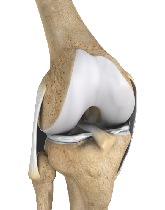 Multiligament Instability