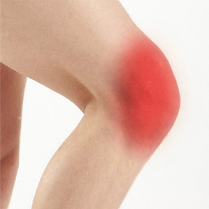 Knee pain - Educational Picture