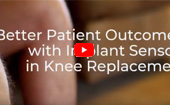 Better Patient Outcomes with Implant Sensors in Knee Replacement - Dr. Paul Jacob