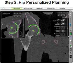 hip-personalized-planning