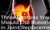 Three Reasons Your Surgeon Should Use Robotics in Joint Replacement - Dr. Paul Jacob