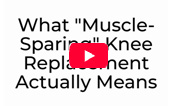 What 'Muscle-Sparing' Knee Replacement Actually Means