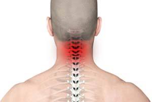  Pain of neck