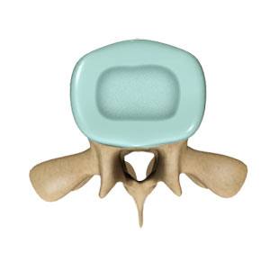 Spinal Stenosis Treatment