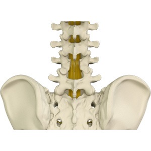 Laminectomy