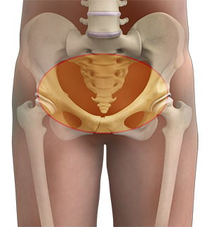 Hip Pain - 3 - Educational Photo