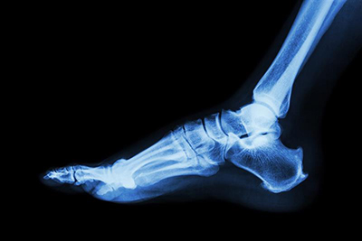 Foot Ankle Joint