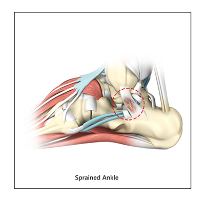 Normal Anatomy of the Foot and Ankle