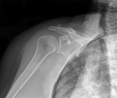 Shoulder Anatomy