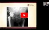 Challenging Cases in THR - Guest Faculty Lecture  logo