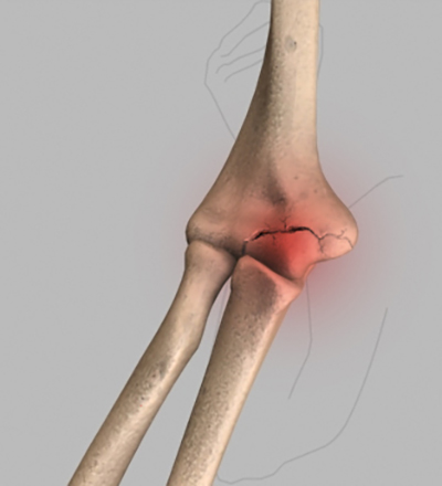 Elbow Anatomy