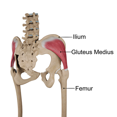Hip Brace